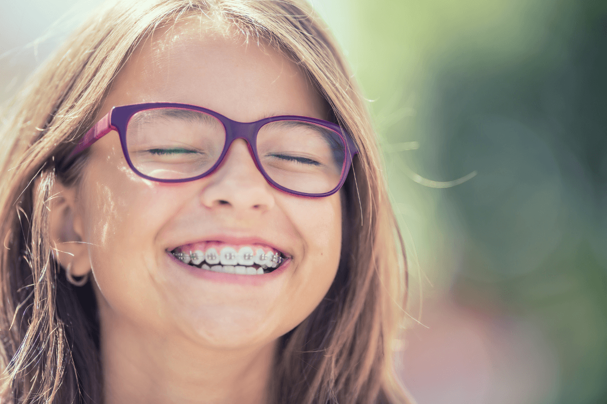 Types of Braces: Your Guide in 2025