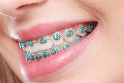 orthodontist braces