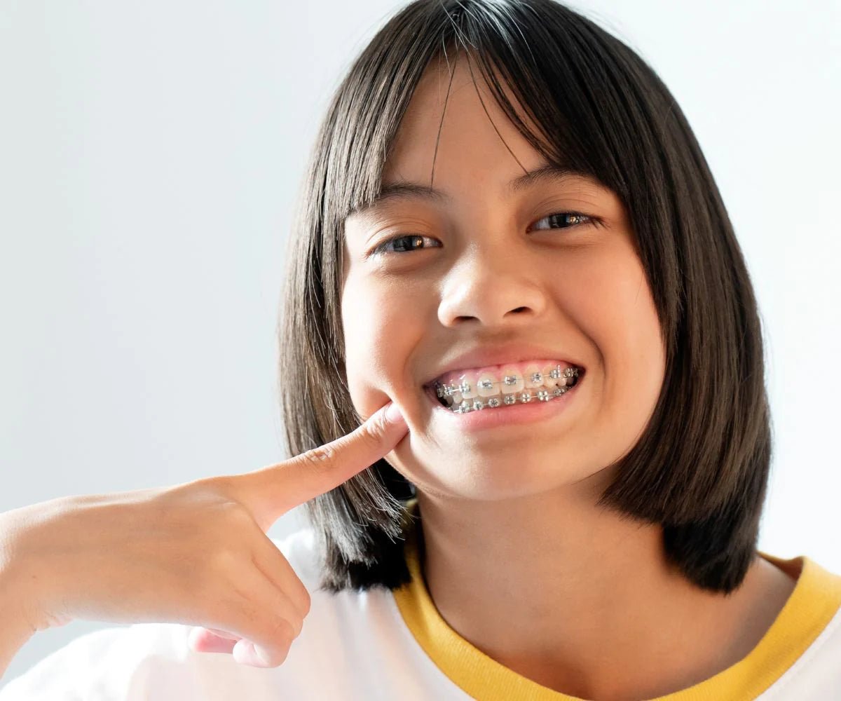 Orthodontists in Culver City Warn About DIY Braces