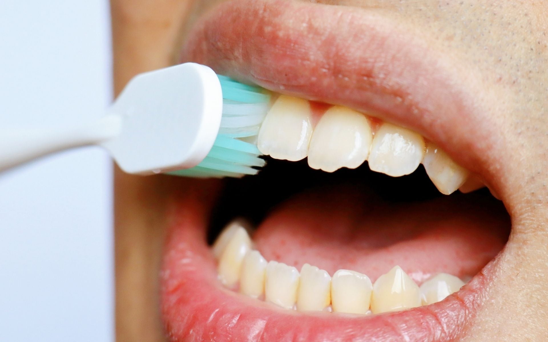 Signs You Need Professional Teeth Cleaning (And When to Act)