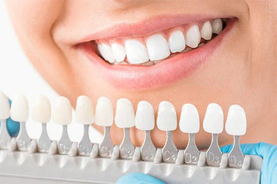 How Much Do Veneers Cost – Guide to Financing Your Treatment