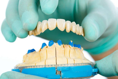 whats happening during the procedure of dental bridges