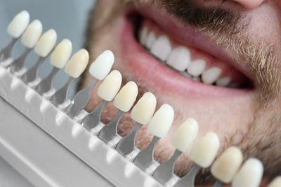dental bonding choosing color to match teeth